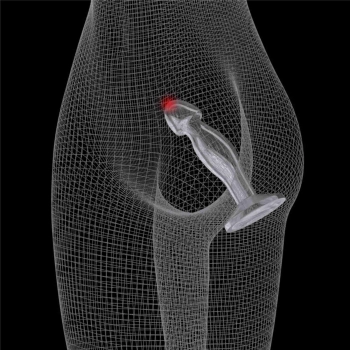 Flawless Clear Prostate Plug 6.5